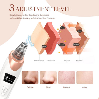 Premium Electric Blackhead Remover | Pore Cleaner | 5 Suction Heads